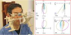 顎機能検査装置